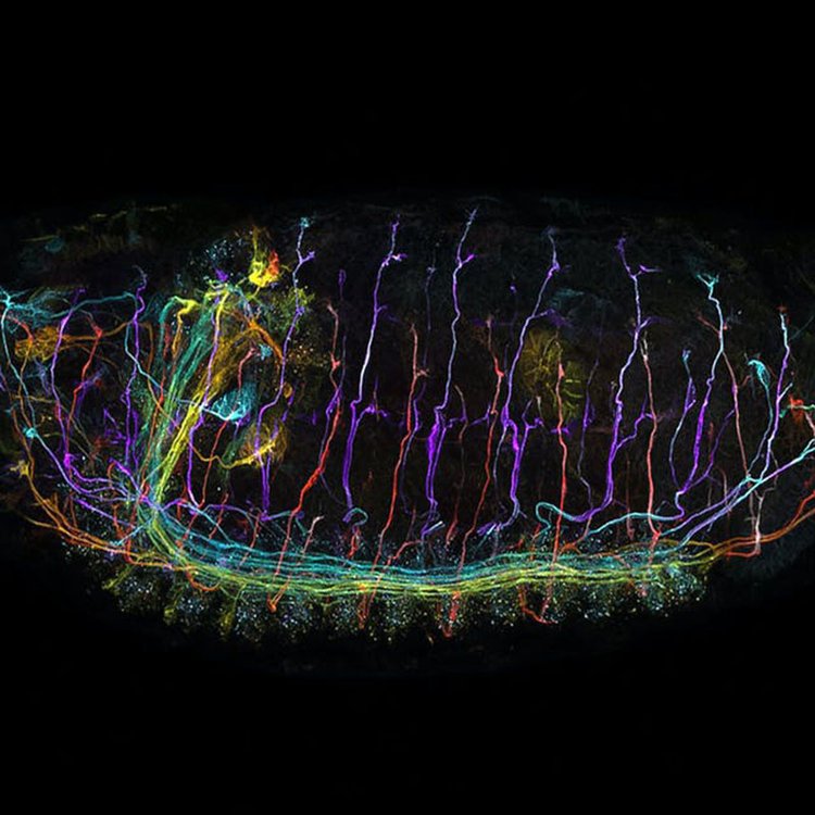 娄底共聚焦显微镜
